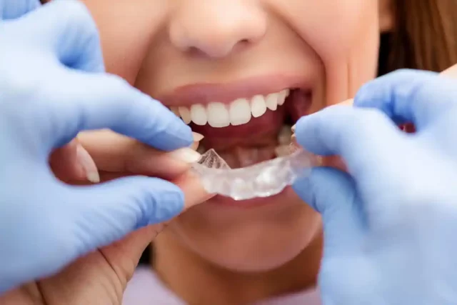Ortodonti Fiyatları Şişli Nişantaşı Dentlotus